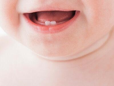 La poussée dentaire chez bébé