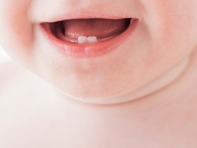 Dentiția la bebeluși
